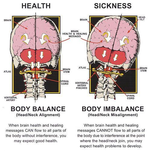 Upper Cervical Chiropractic In Encino In San Fernando Valley