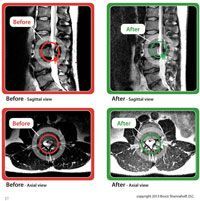 MRI Brian