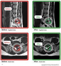 MRI Raju